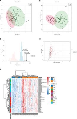 Plasma lipidomics of primary biliary cholangitis and its comparison with Sjögren’s syndrome